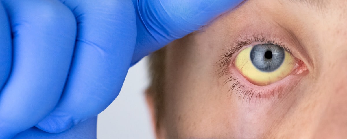 Des jardiniers parisiens demandent à se faire vacciner contre la leptospirose