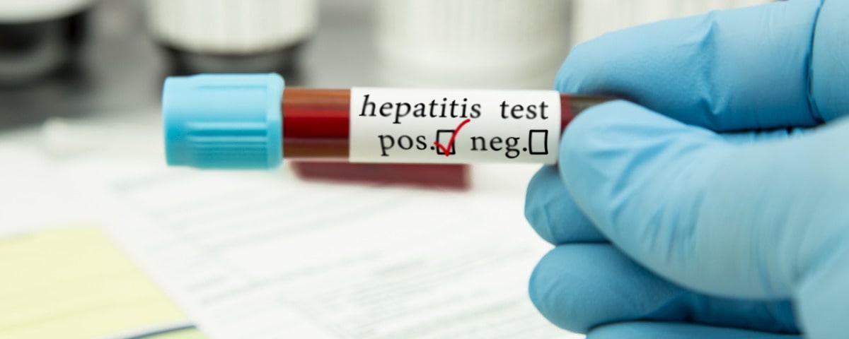 Journée mondiale contre l’hépatite 2023 : sensibiliser, agir et porter les couleurs