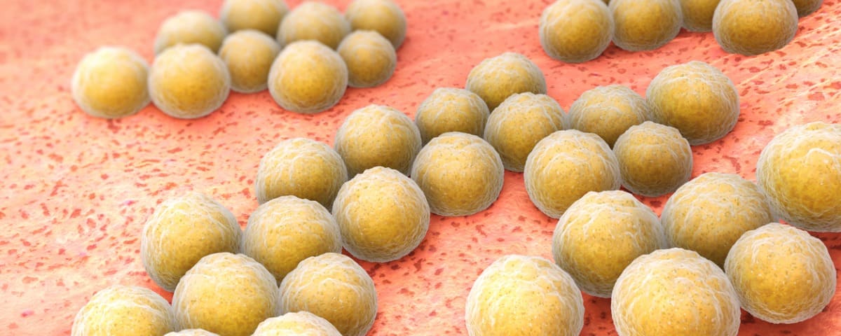 L’espoir d’un vaccin pour lutter contre le staphylocoque doré