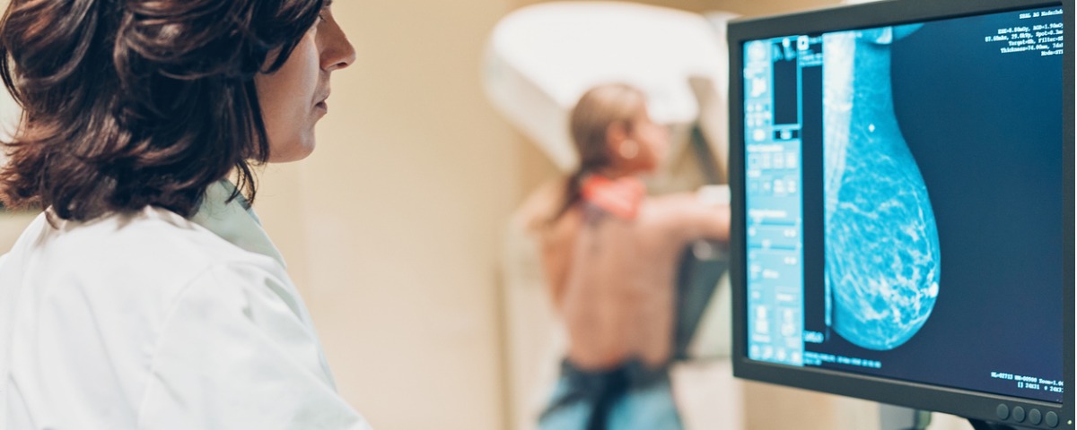 Dépistage du cancer : la France en retard par rapport à ses voisins européens