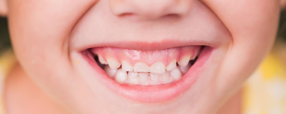Vers une génération sans caries : l’Assurance Maladie intensifie la prévention dentaire