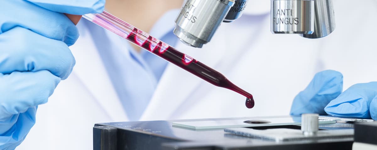 Le dépistage de la drépanocytose appliqué à tous les nouveau-nés depuis le 1er novembre