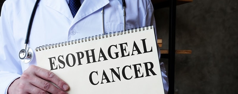 Cancer de l'oesophage et assurance prêt immobilier