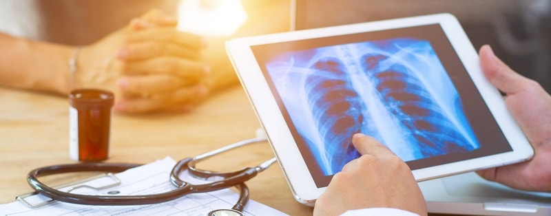 analyse d'une radio de cancer des poumons