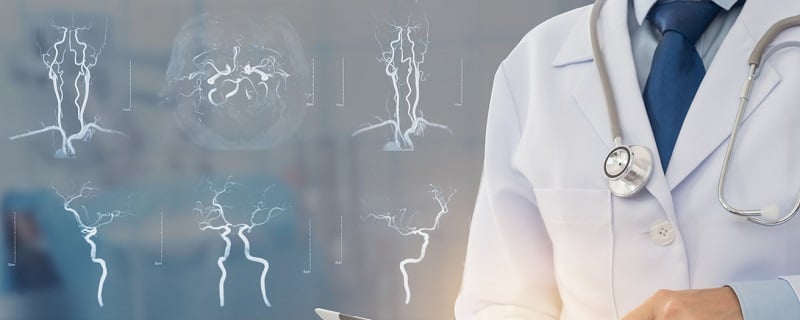 Assurance de pret avc