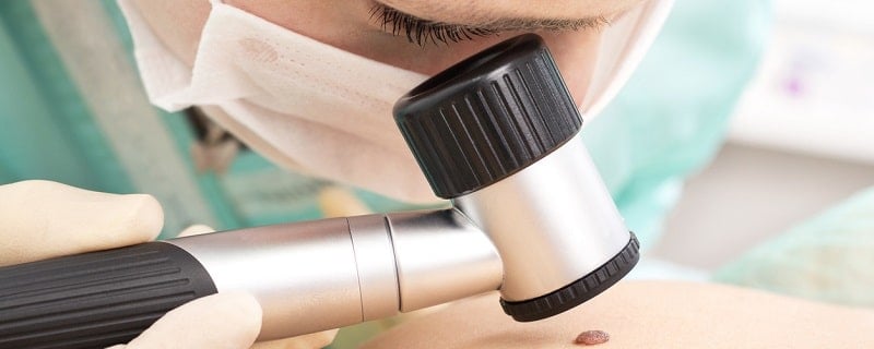 Cancer de la peau et assurance prêt immobilier