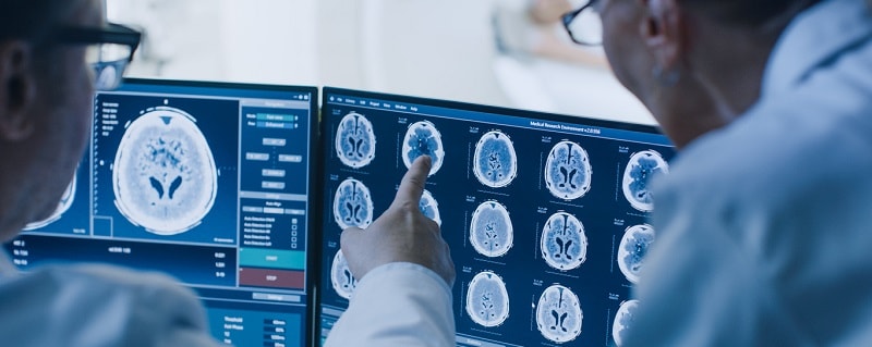 Maladie neurologique et assurance de prêt immobilier