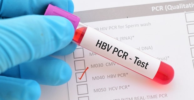 Prélèvement de sang dans l'optique de décéler l'hépatite